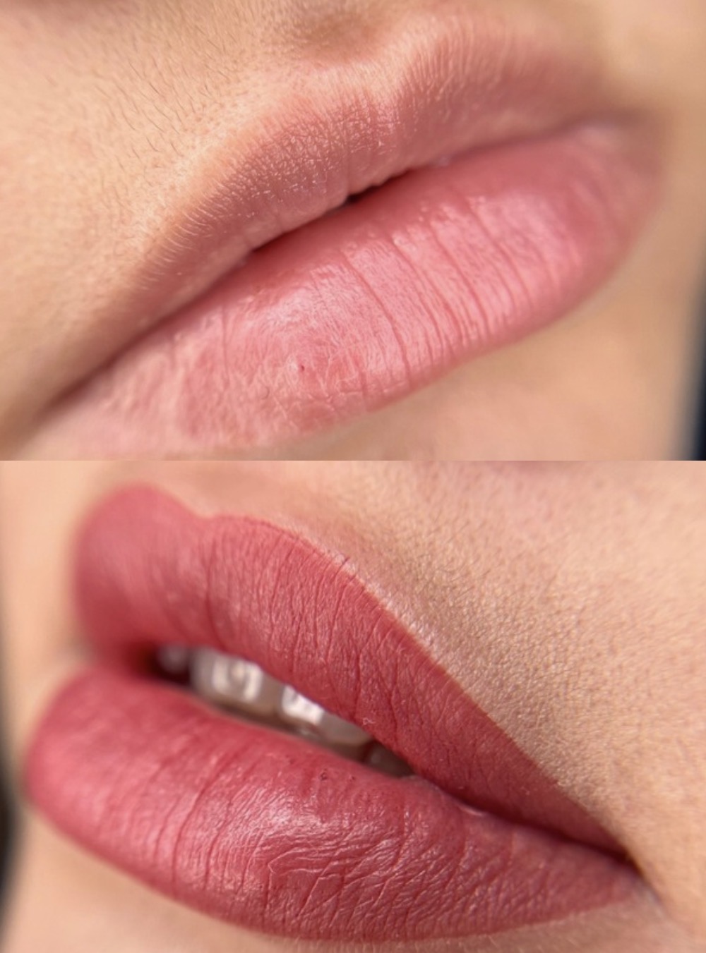 Avant/Après dermopigmentation des lèvres