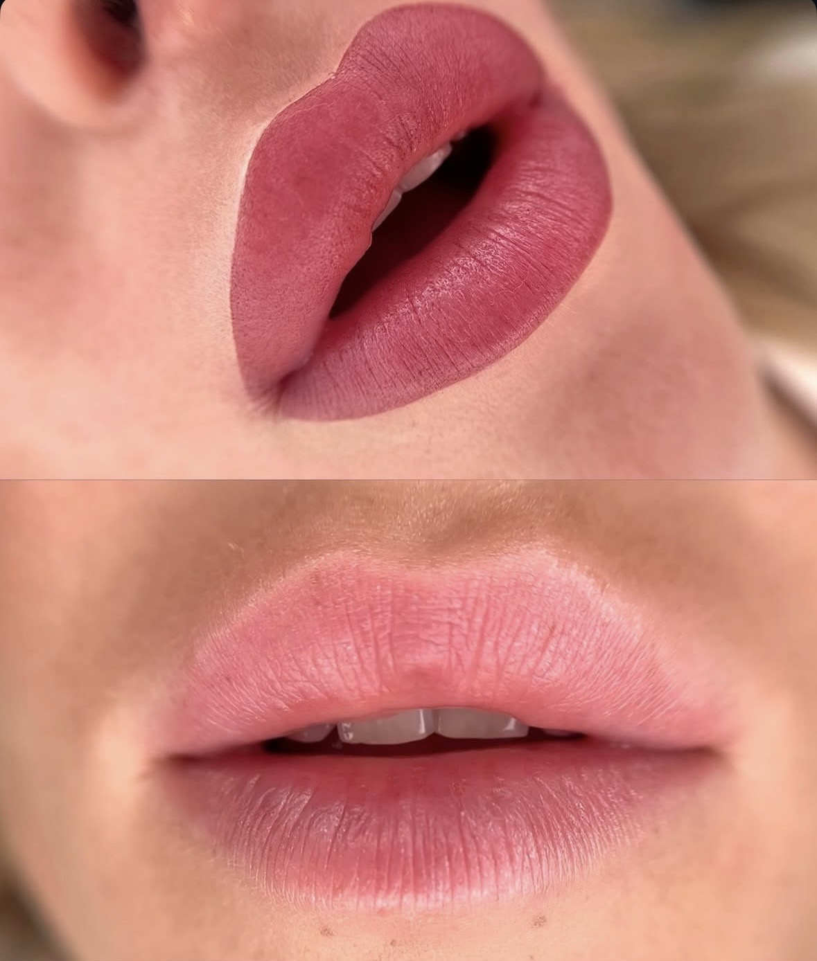 Avant/Après dermopigmentation des lèvres